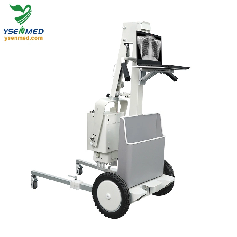 Ysx056-Pd 5.6kw Digital Portable X-ray Machine